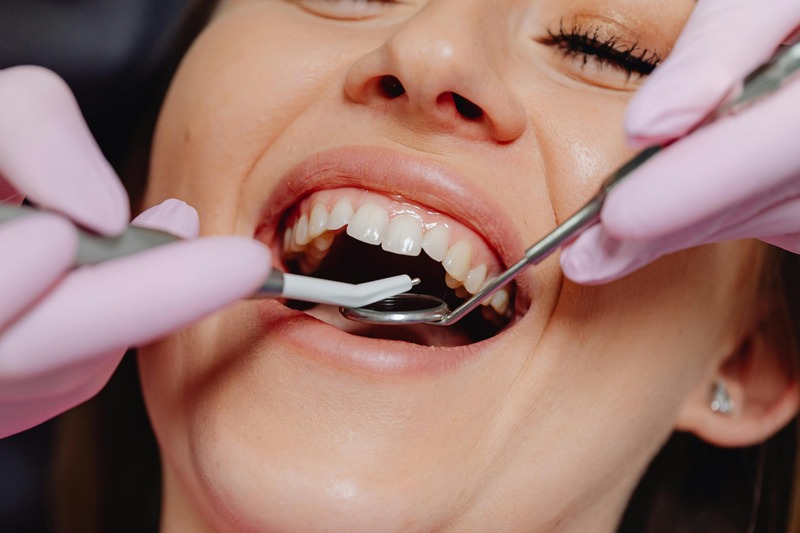 How Flowable Composites Help Prevent Chips and Cracks in Dental Restorations